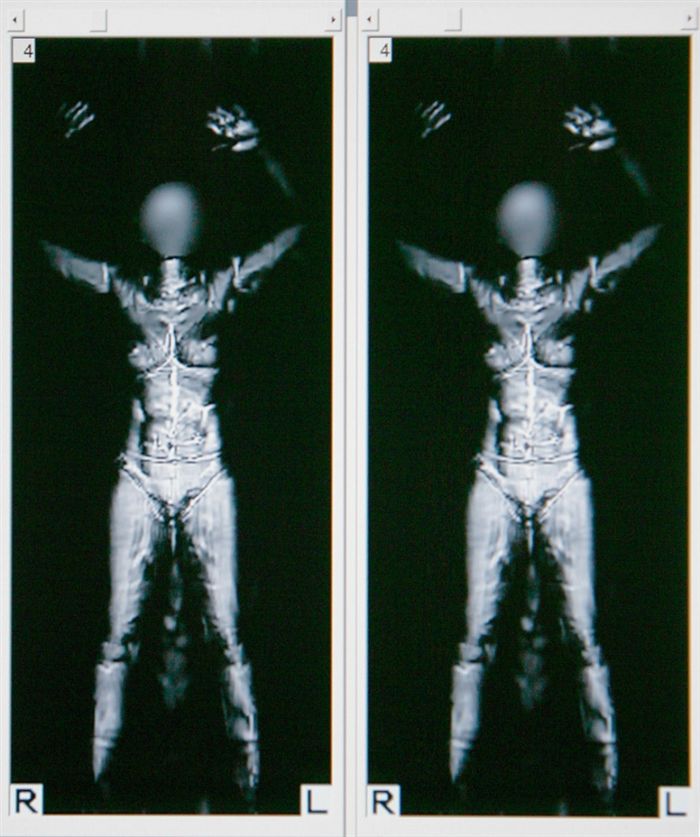 Изображение: Изображение сканера всего тела